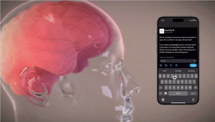 首个Neuralink脑机接口人类已完全康复 可用意念操控鼠标